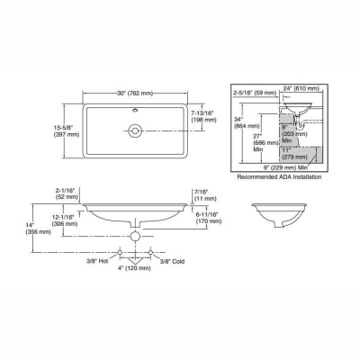 Kohler Lavabo İron Plans Döküm 76 x 40 cm Beyaz - Thumbnail 10KOH20212-W-0